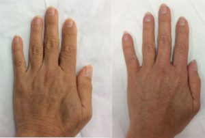 Dermal-Fillers_0008_Layer-0---9